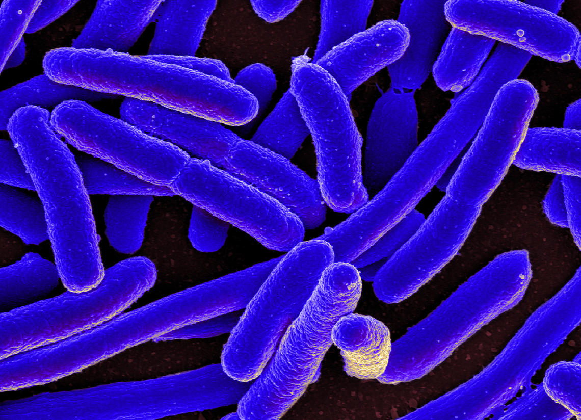 Resistance to antibiotics is on the rise worldwide because of the overuse and misuse of medications, which can also lead to other health issues like drug toxicity or complications. “Microbe” by NIAID via Foter.com is licensed under CC by 2.0.
