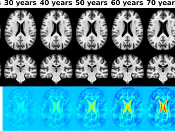 Brain age scan