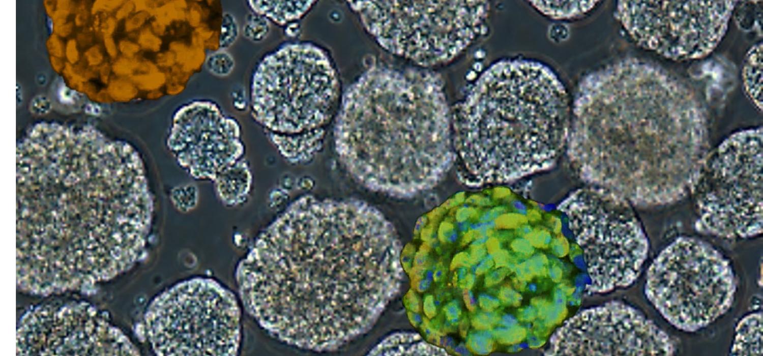 naive pluripotent stem cells